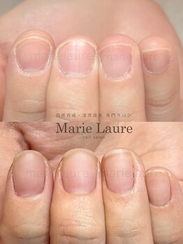 マリーロール 淀屋橋本店(Marie Laure)/自爪育成/深爪矯正/ネイルケア