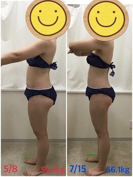 エスティフル 狭山店(ESTIFUL)/[痩身エステ]Before/After