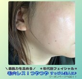 あるま