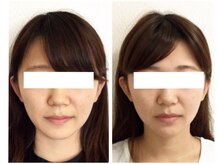 美容整体 ウェリナ 蟹江院/小顔矯正/骨盤矯正/美脚サロン