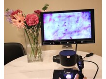 オードリリー(eau de Lily)/毛細血管をチェック