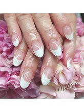 アイネイル(iNAIL)/