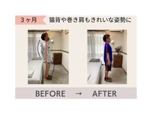 リワイ整体院/猫背/巻き肩/姿勢改善もお任せ！