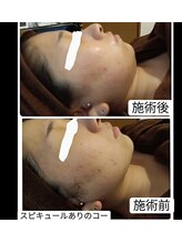 ウリア(ULIA)/まずは３カ月で効果を実感☆