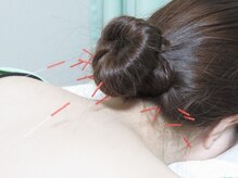 ヤマザキ治療院