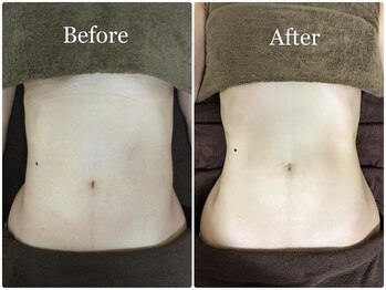 エミット(emit.)/腸リンパマッサージ