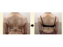 エステティックサロン ピュール ボーテ 東金店/バストは残してダイエット！