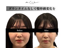 アロエベル(aloe Belle)