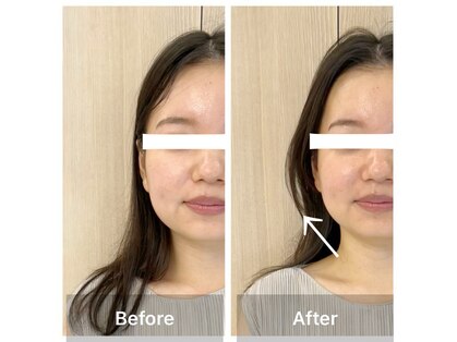 アスト(AST)の写真