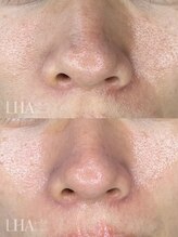 ピュアソル 福岡店(Puresol)/ララピール