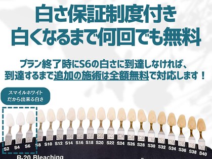 スマイルホワイト 赤羽店の写真