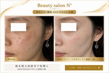 ナンバー(N°)
