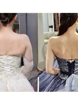 シンビューティーサロン 大宮本店の写真/花嫁様支持率No.1!ドレスが映える華奢ボディへ導く、花嫁専用痩身ケア♪結果重視で自身のある理想の身体に!