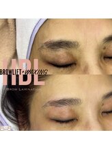 エリス(ELISSE)/ハリウッドブロウリフト