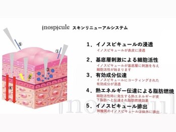 ゼアー(THERE FY.)/基底膜まで届くHARIを採用