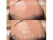 サンウェーブ(SUN WAVE)の雰囲気（フェイシャルワックス）