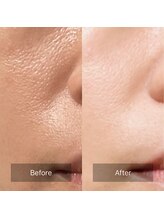 ウツクシ 三軒茶屋(UTUKUSHI)/before→after　