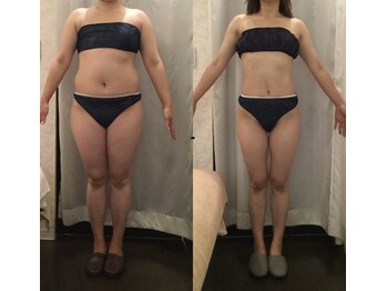 イロドリ 南浦和(irodori)/産後骨盤矯正Before＆After