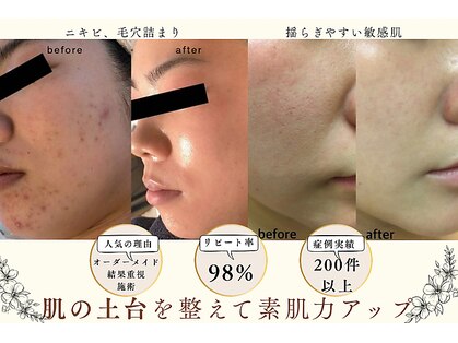 プログレス(PROGRESS)の写真