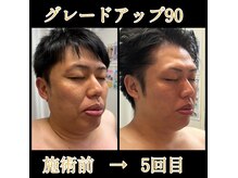 リリーローズ(LilyRose)の雰囲気(積み重ねで変わる顔つき。【首肩・後頭部の硬さは若さに直結】)