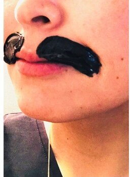 ワックスラボ(WAXLAB)/口周りWAX脱毛