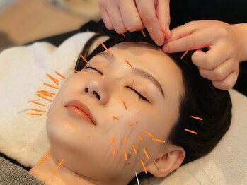 銀座 はり香/話題の美容鍼