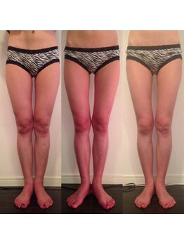 レナトゥス 銀座(Renatus)/BeforeAfter