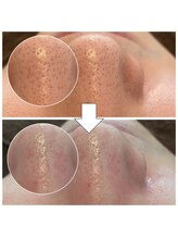 ペイジ(peige)/【peige】症例写真