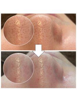 ペイジ(peige)/【peige】症例写真