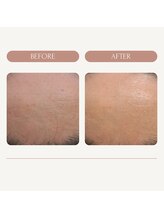 エミナル バイ ニコドット(Eminal by nico.)/乾燥肌が気になりケアスタート