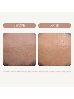 エミナル バイ ニコドット(Eminal by nico.)/乾燥肌が気になりケアスタート