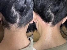 キャメル ネイル(camel nail)の雰囲気（首が長く見え清潔感の出るうなじワックス脱毛日本産ワックスです）