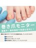 【1日1名限定】無料巻き爪モニター！足の親指または他の指の爪（２本まで）