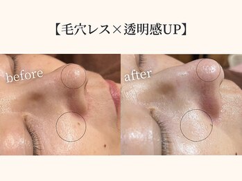 ドリームスパ 町田店(DREAM SPA)/before→after