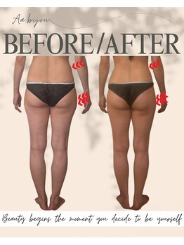 エイエービジュー(Aa.bijou)/