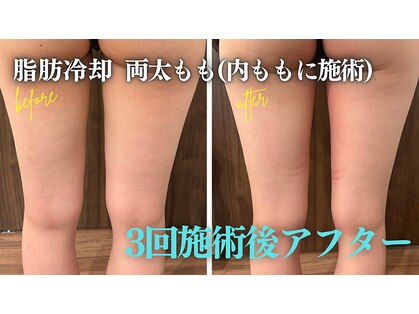 クリーンビューティーメディカルサロン(CLEAN BEAUTY Medical Salon)の写真