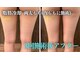 クリーンビューティーメディカルサロン(CLEAN BEAUTY Medical Salon)の写真