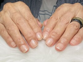 【自爪育成】深爪、薄い爪悩みに