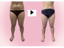 ヨサパーク ロワゾーブルー(YOSA PARK Loiseau blue)/頑固なお腹も撃退！