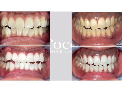 ココホワイトニング 天王寺店の写真