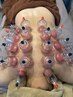 【老廃物/デトックス効果】全身アロマ100分＋カッピングコース