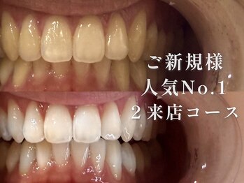 ナルムホワイトニング 代々木(NARUM whitening)の写真/【ホワイトニング】効果にこだわるサロン