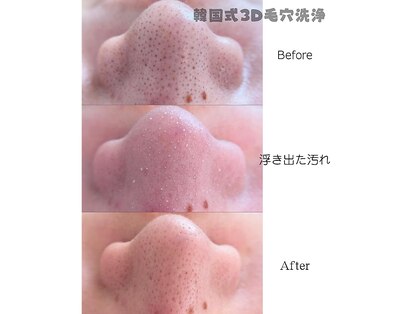 ミステ(MISTE)の写真