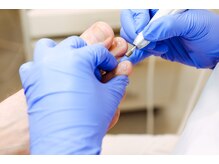 テネシー/タコ・魚の目も「フスフレーゲ」