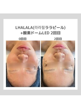 ポムハヌル(pom.haneul)/韓国肌管理室