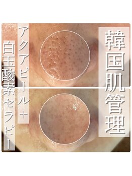 ペイジ(peige)/【peige】症例写真