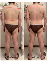 ベルヴィー(Belle vie)/男性デリケートゾーンケア120分