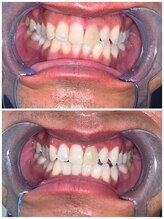 ライトビューティー 池袋店(LightBeauty)/症例写真