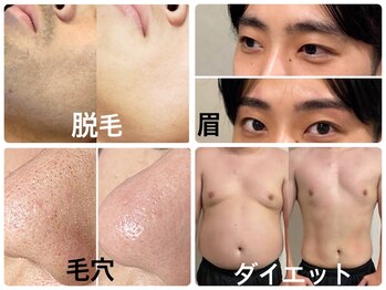 メンズガーデン(men's Garden)