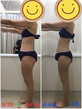 エスティフル 狭山店(ESTIFUL)/[痩身エステ]Before/After